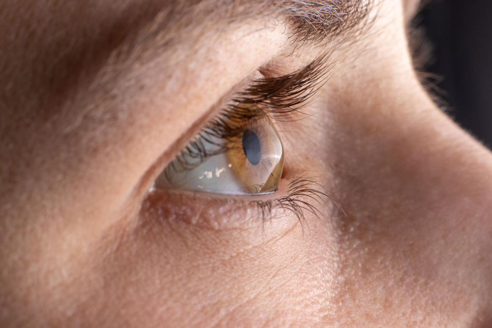 Keratoconus Las Vegas, NV
